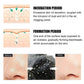 Black Head Removal Nose Strips