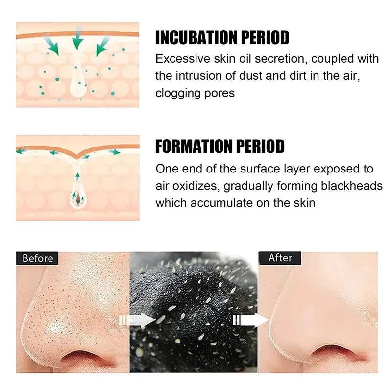 Black Head Removal Nose Strips