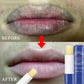 Lip Balm Stick